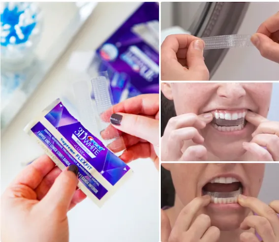 30174 teeth whitening products