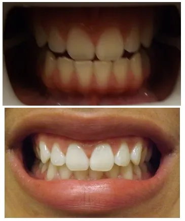 30177 healthy smile