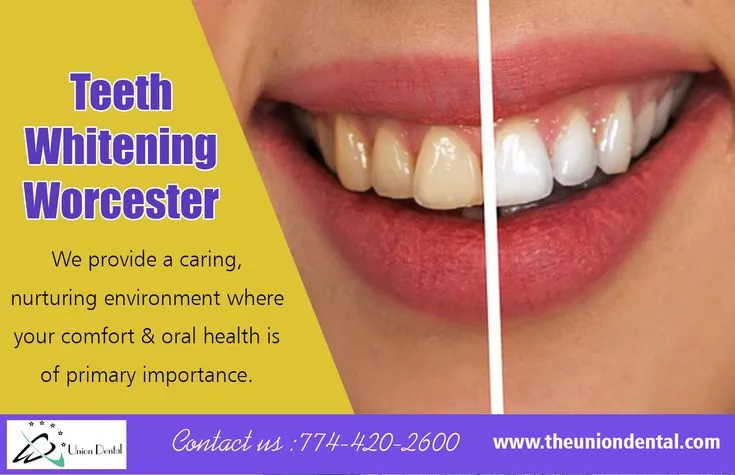 30177 teeth whitening worcester