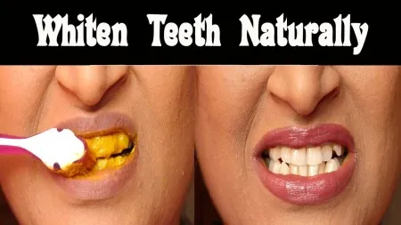 30180 natural teeth whitening ingredients