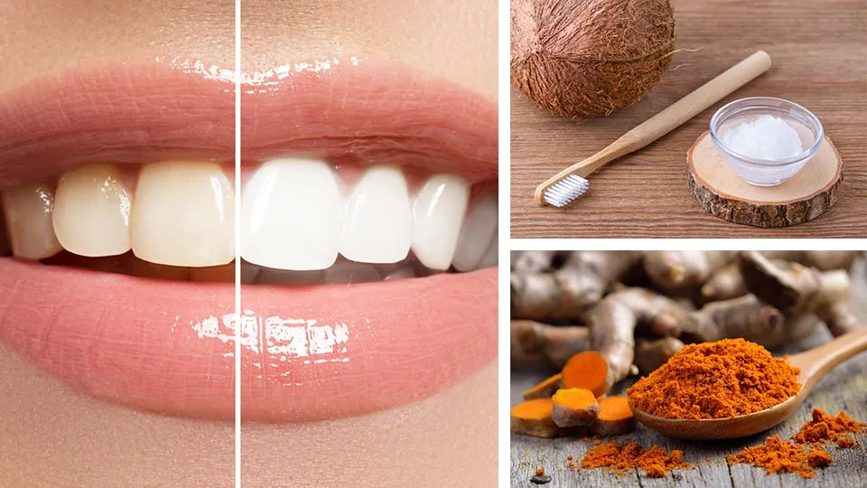 30180 turmeric and coconut oil teeth whitening