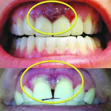 30184 hydrogen peroxide sensitivity
