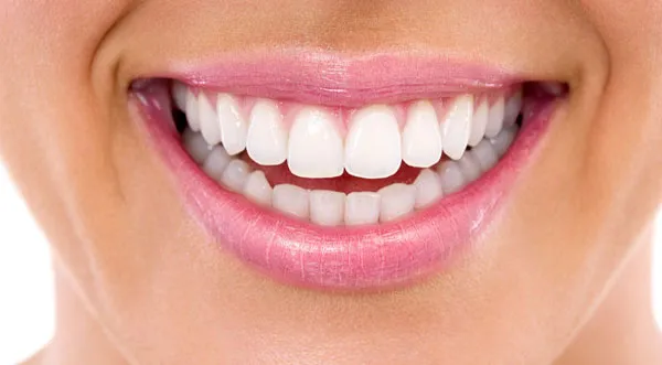 30191 teeth whitening rockville md image5