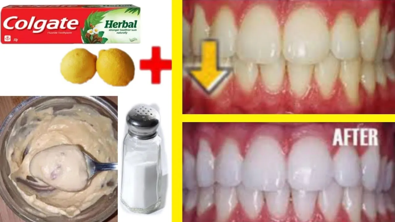 30194 salt and lemon juice teeth whitening 4