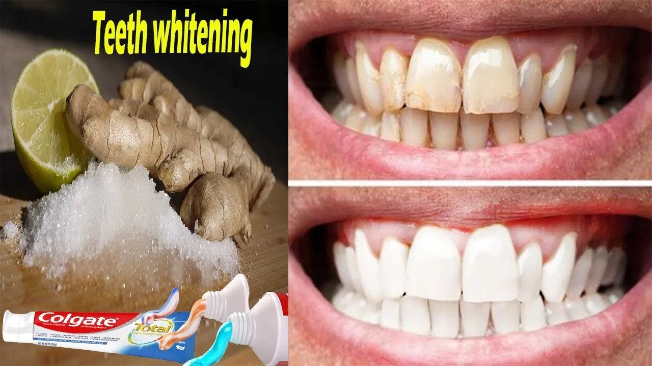 30194 salt and lemon juice teeth whitening 5