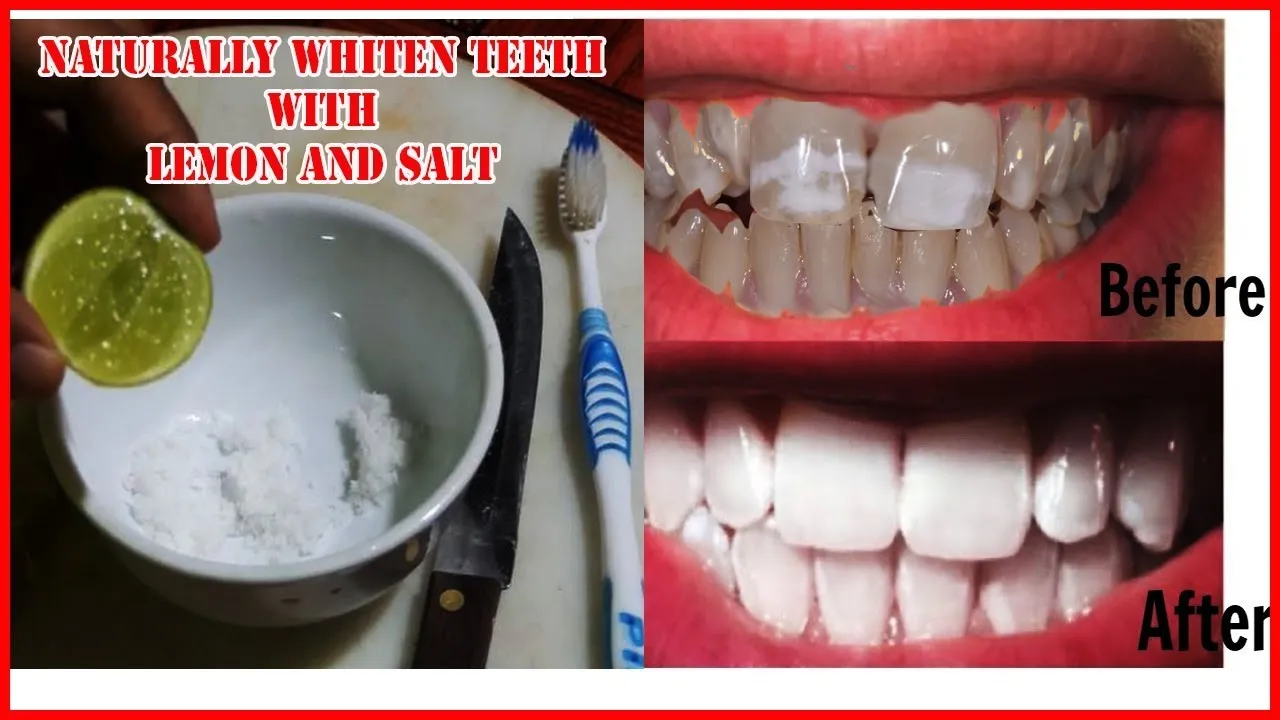 30194 salt and lemon juice teeth whitening 6