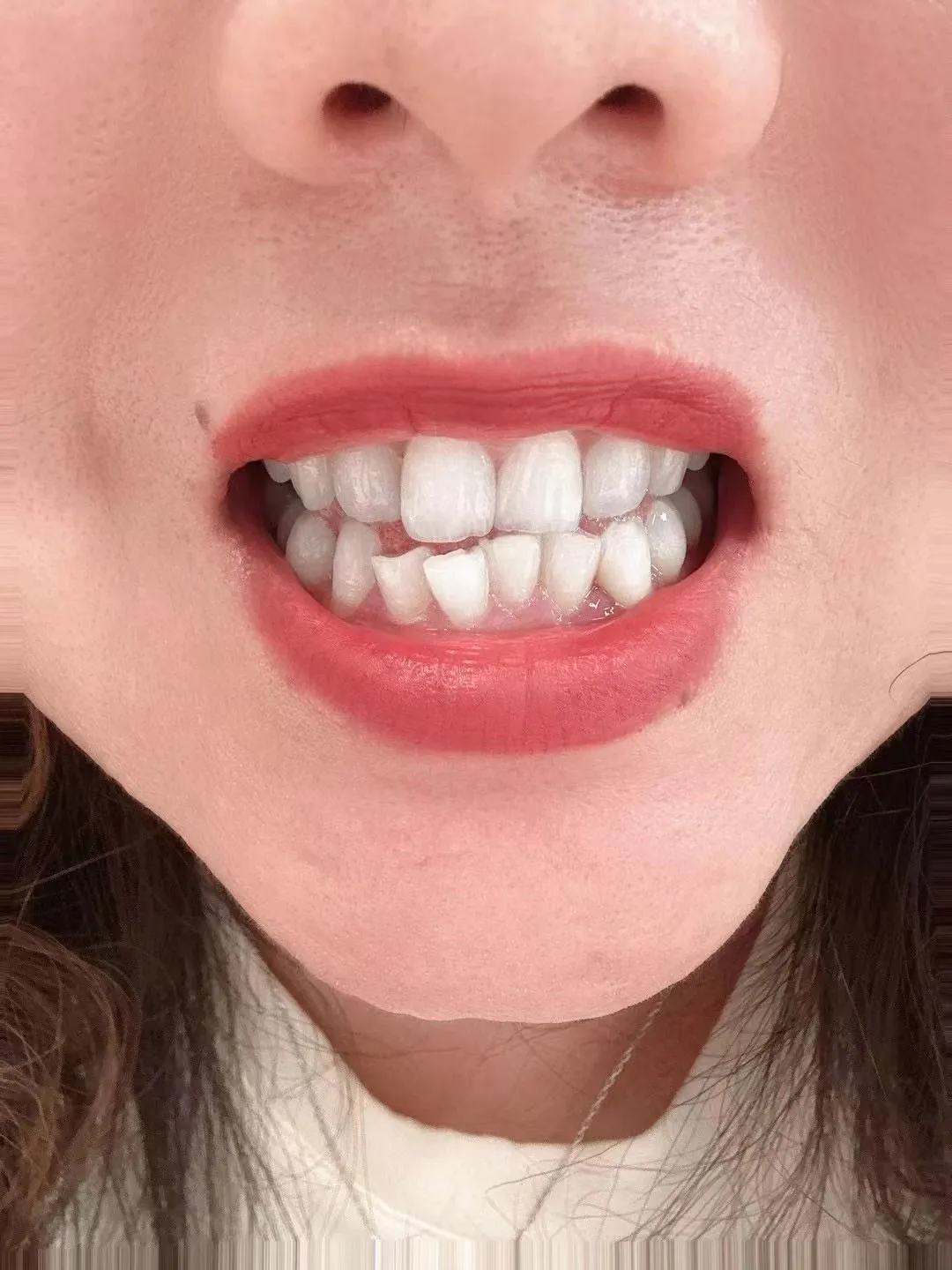 30196 brushing flossing shirley