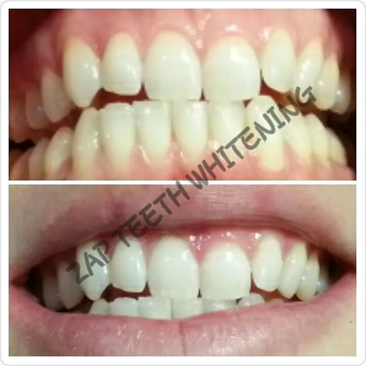 30196 diet teeth shirley