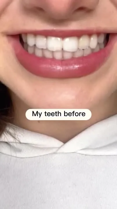 30196 professional whitening shirley