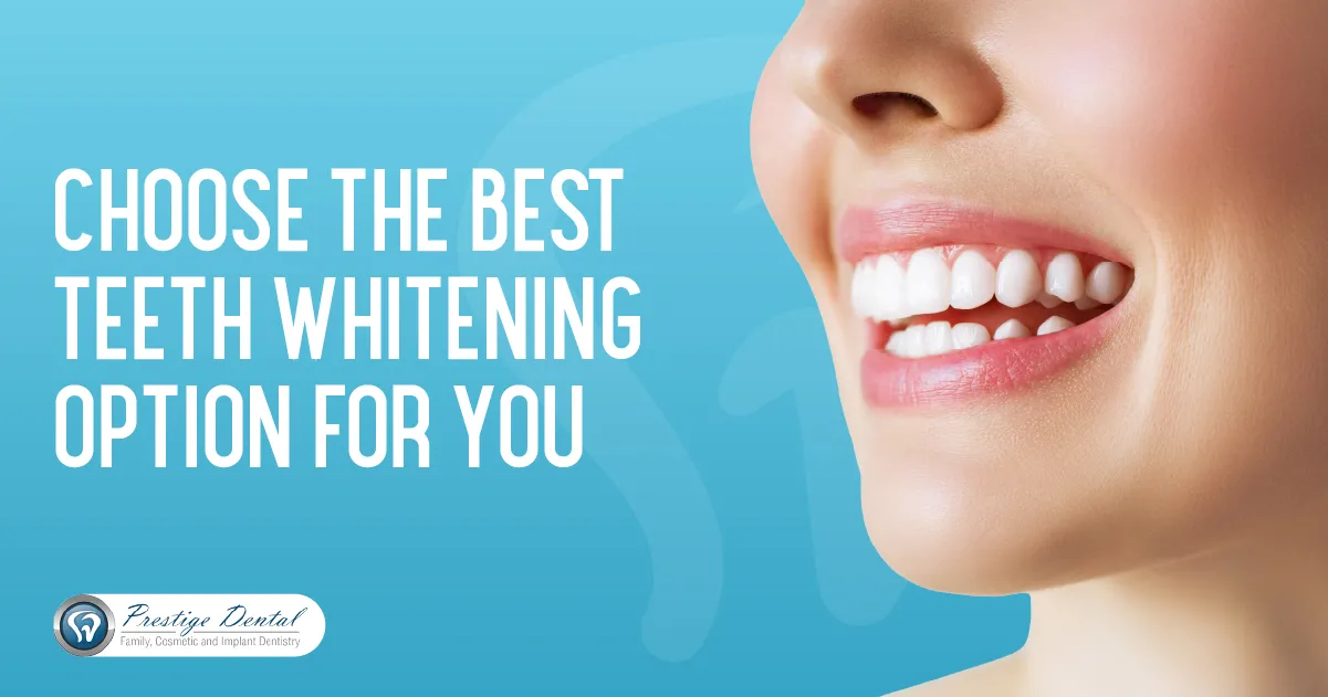 /img/30200-pasadena-teeth-whitening-consultation.webp