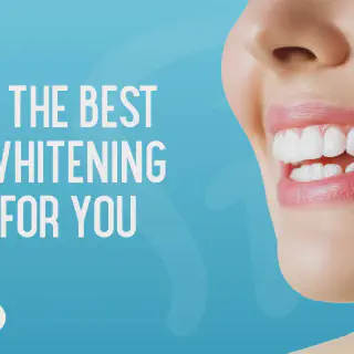 /img/30200-pasadena-teeth-whitening-consultation.webp
