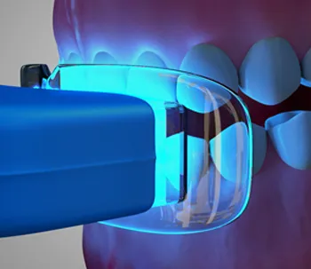 30200 pasadena teeth whitening oral hygiene