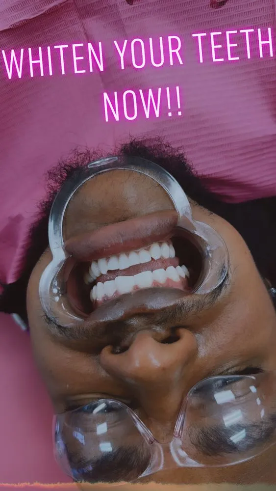 30202 teeth whitening aftercare