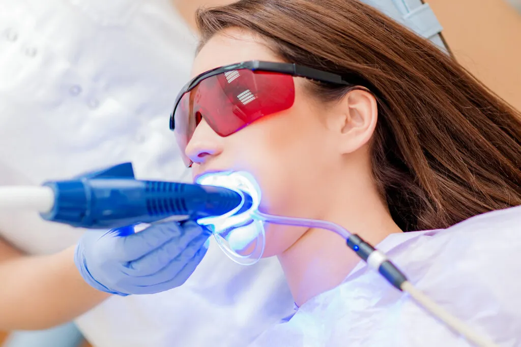 30207 laser teeth whitening fayetteville nc banner