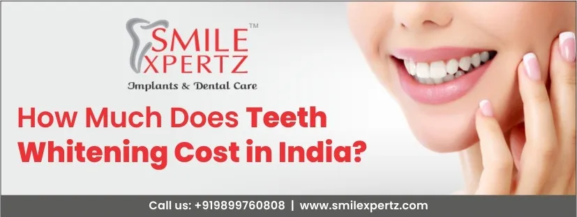 30212 in office teeth whitening