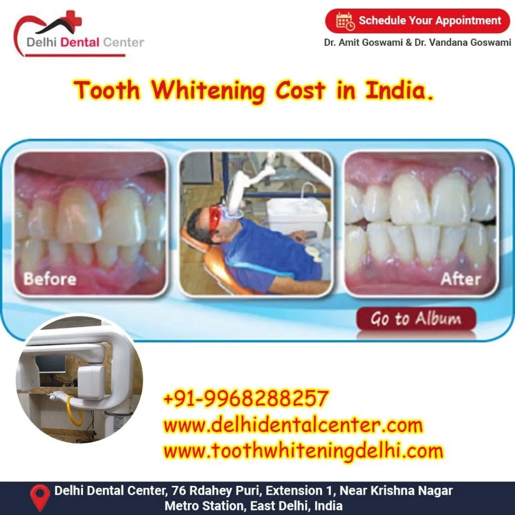 /img/30212-teeth-whitening-before-after.webp