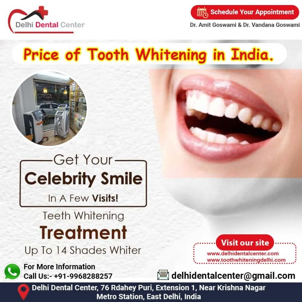 30212 teeth whitening cost comparison