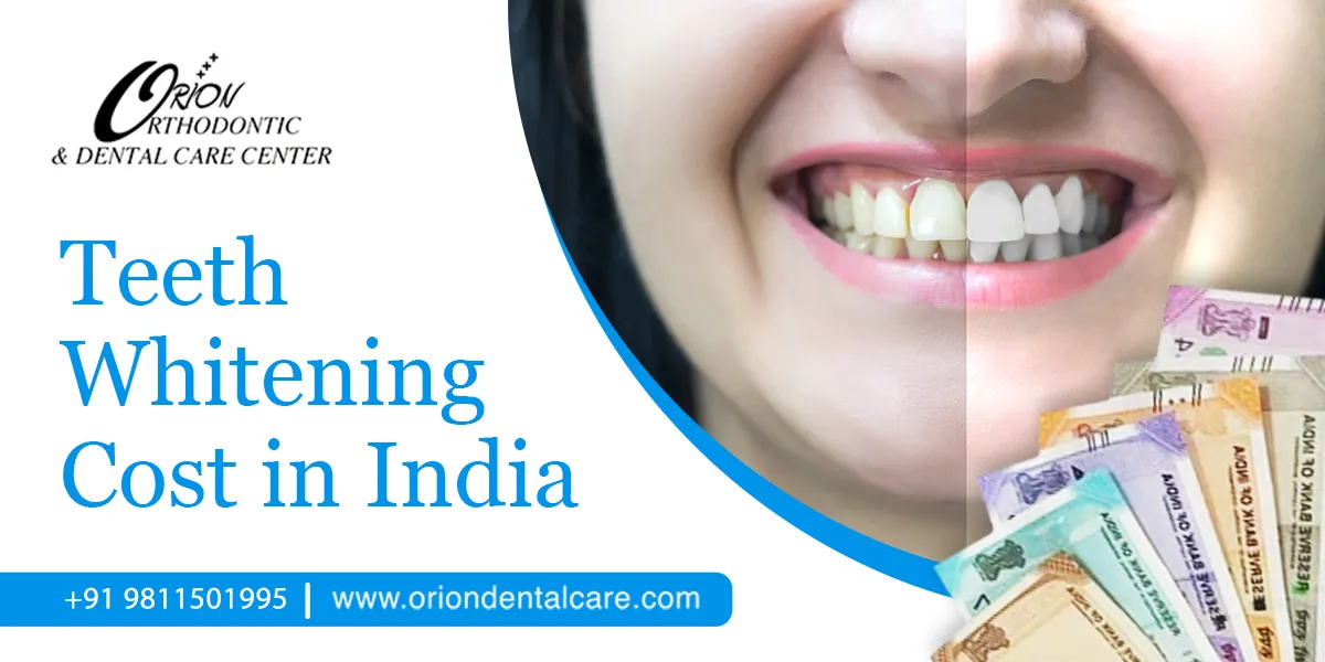 30212 teeth whitening india overview