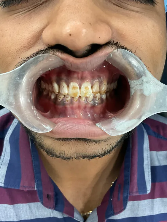 30212 teeth whitening payment plans