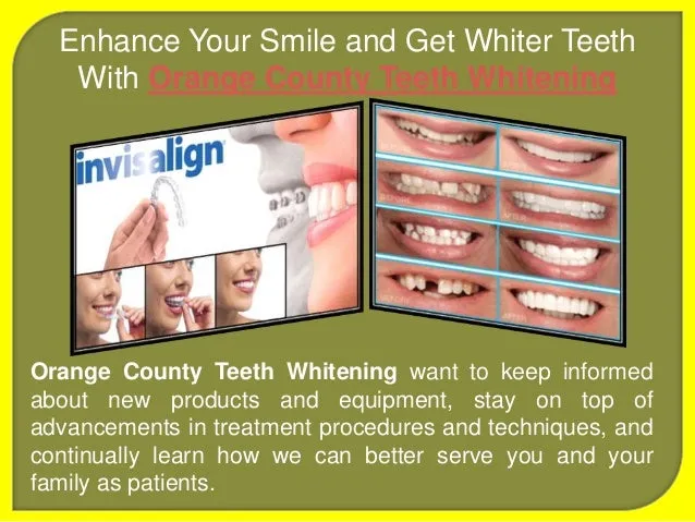 30213 teeth whitening oc professional