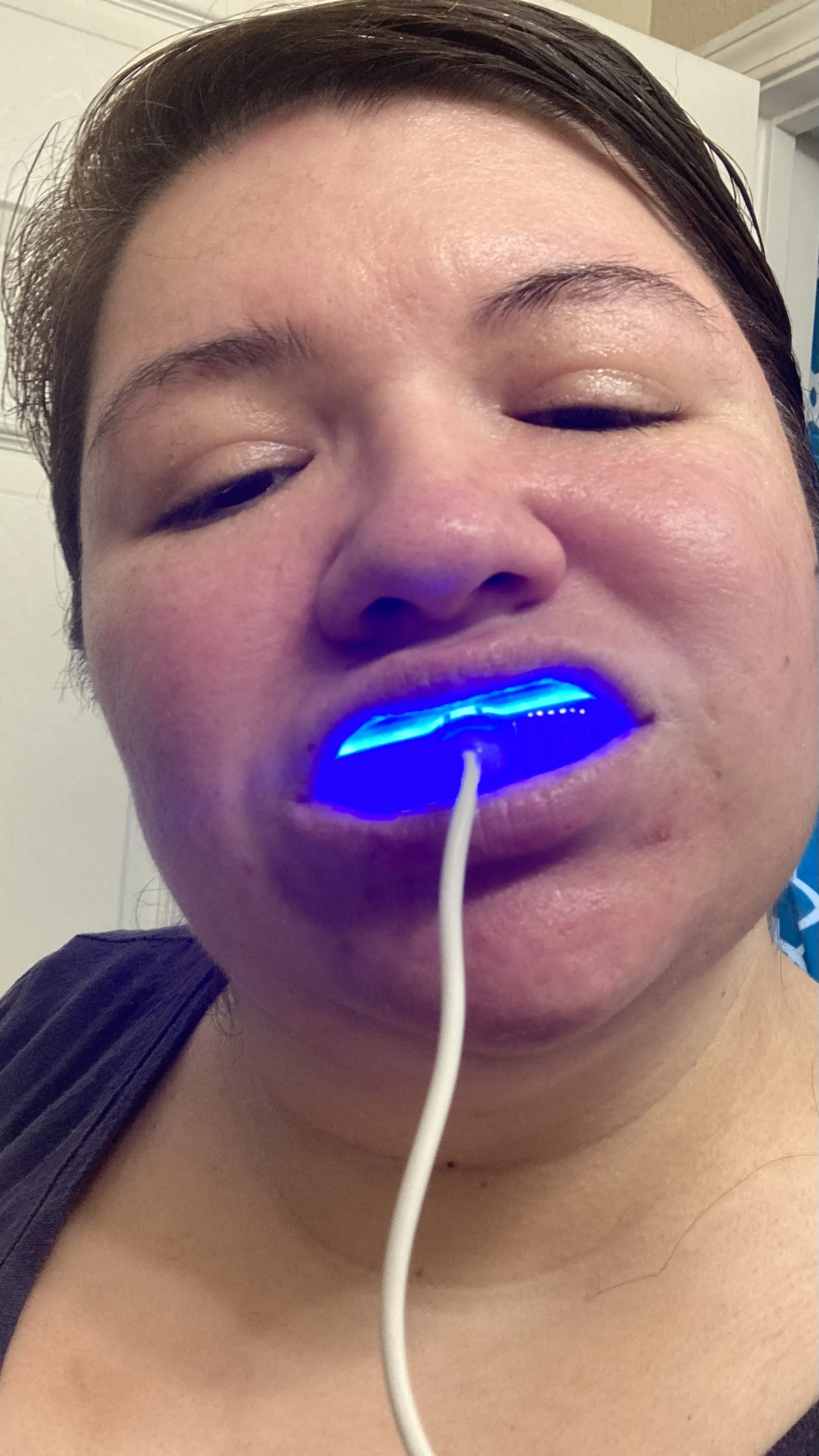 30214 teeth whitening maintenance