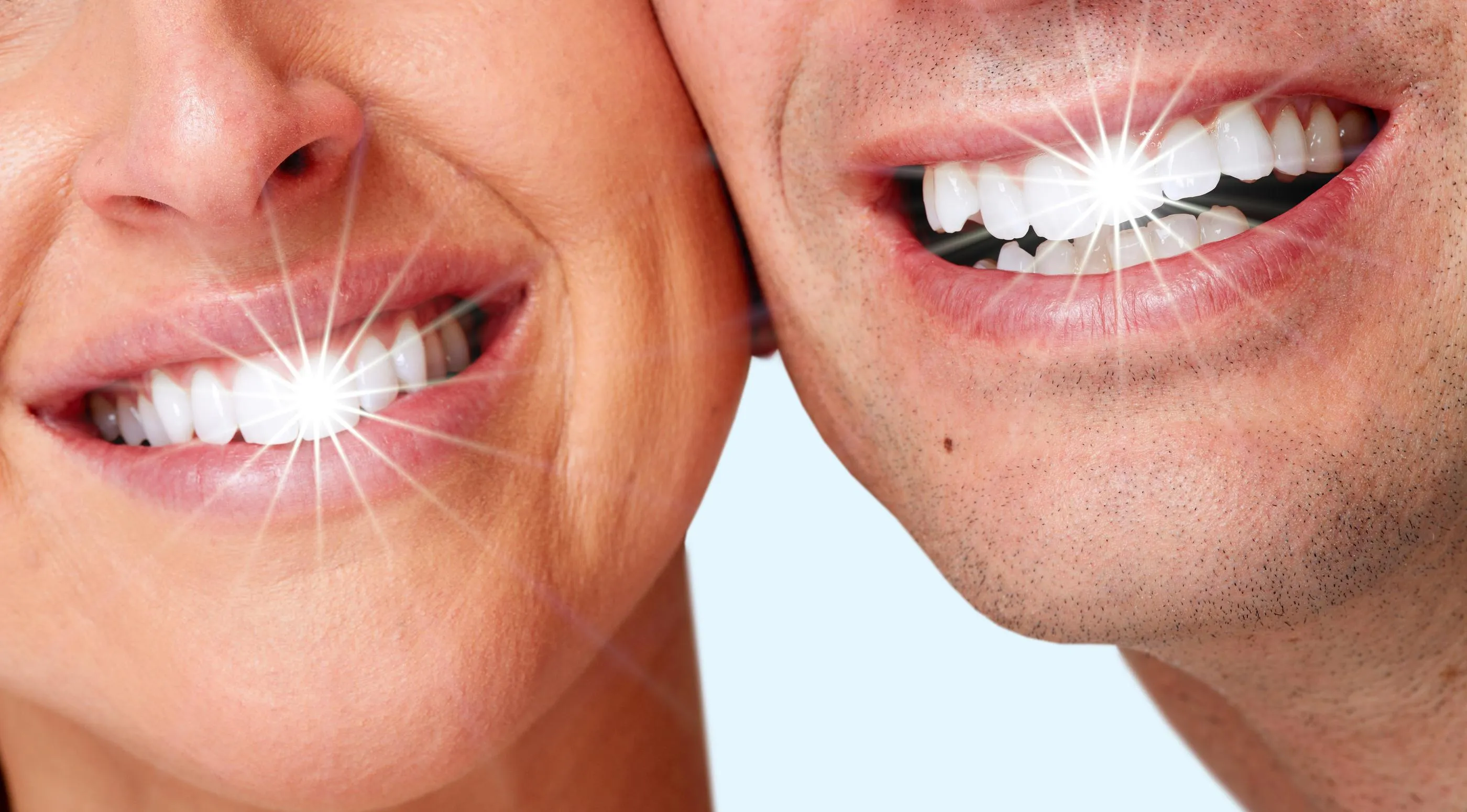 30217 san jose teeth whitening options