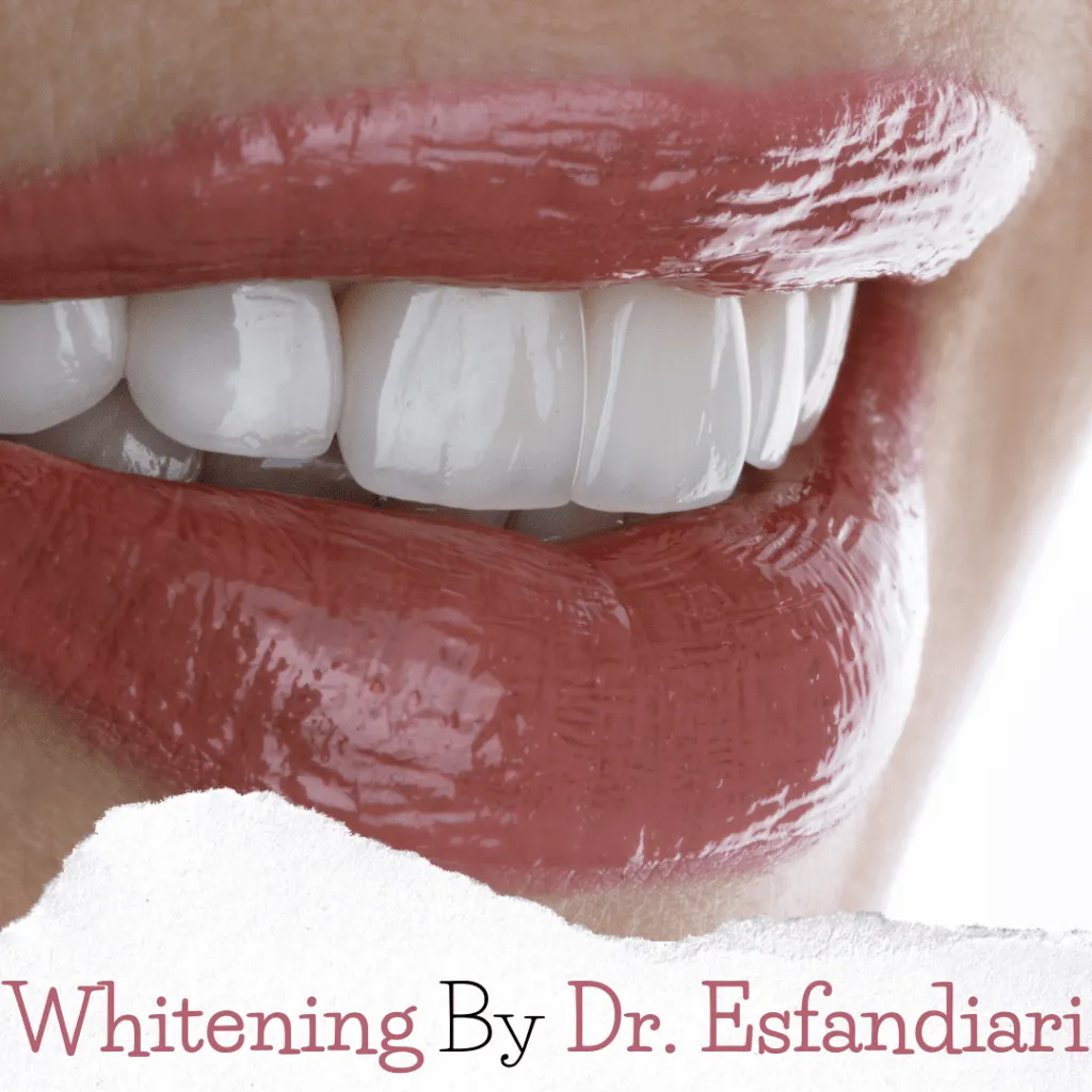30217 teeth whitening foods drinks