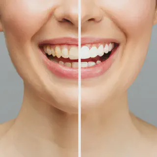 /img/30217-teeth-whitening-smile.webp