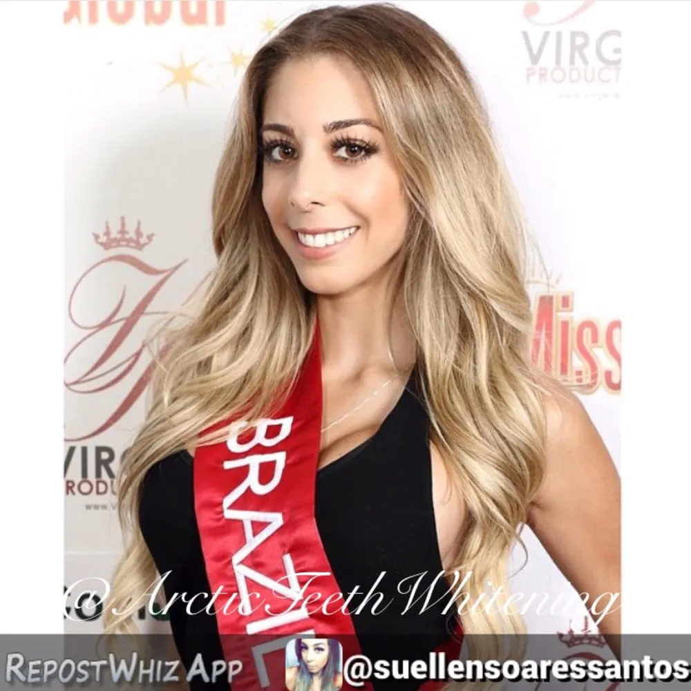 30223 arctic teeth whitening encino whitening process