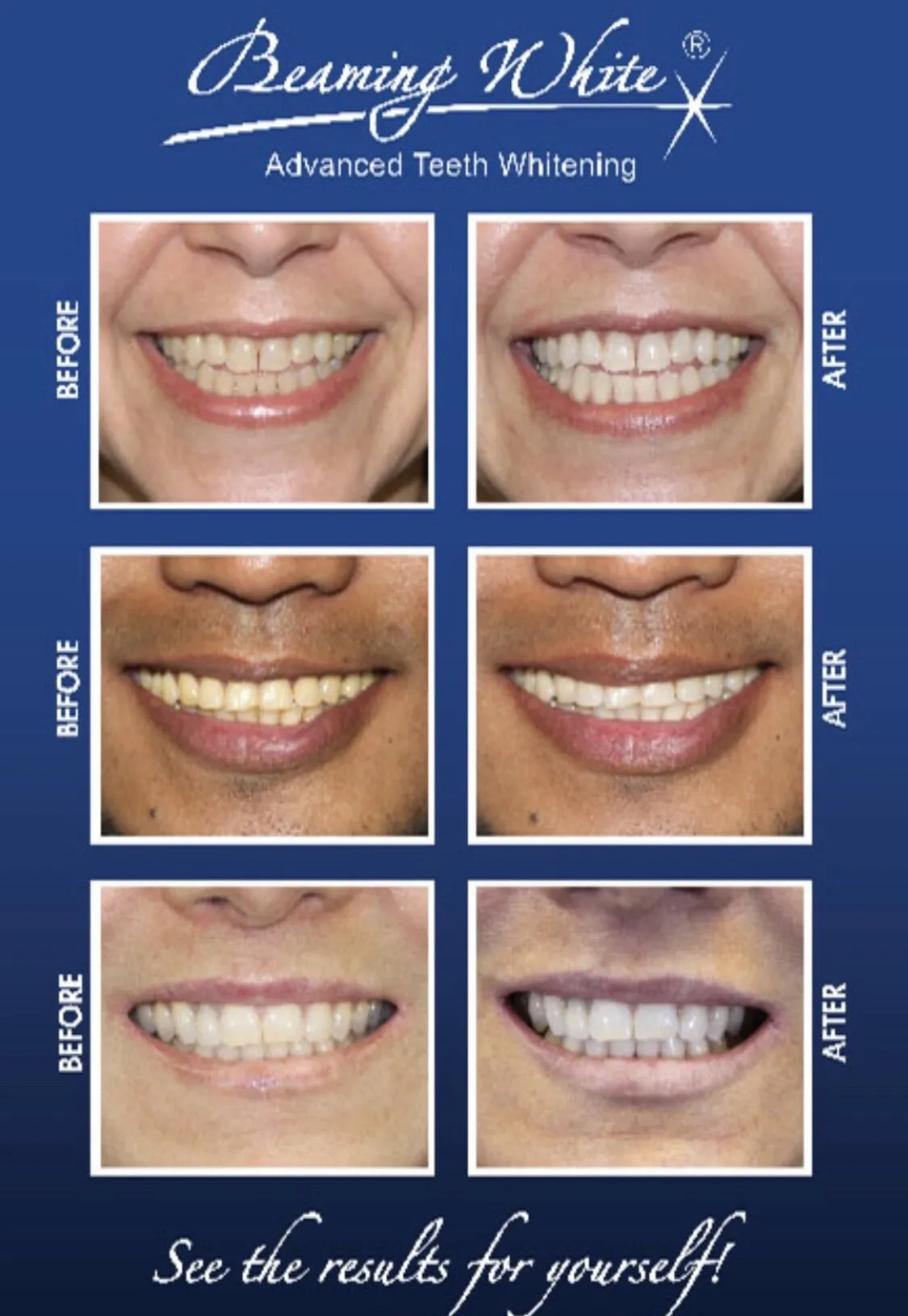 /img/30224-teeth-whitening-stratford-dental-checkup.webp