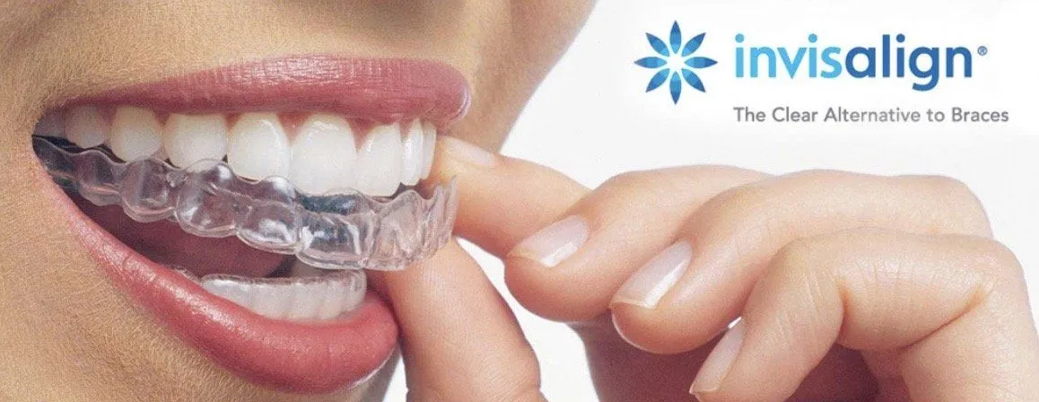 30224 teeth whitening stratford healthy gums