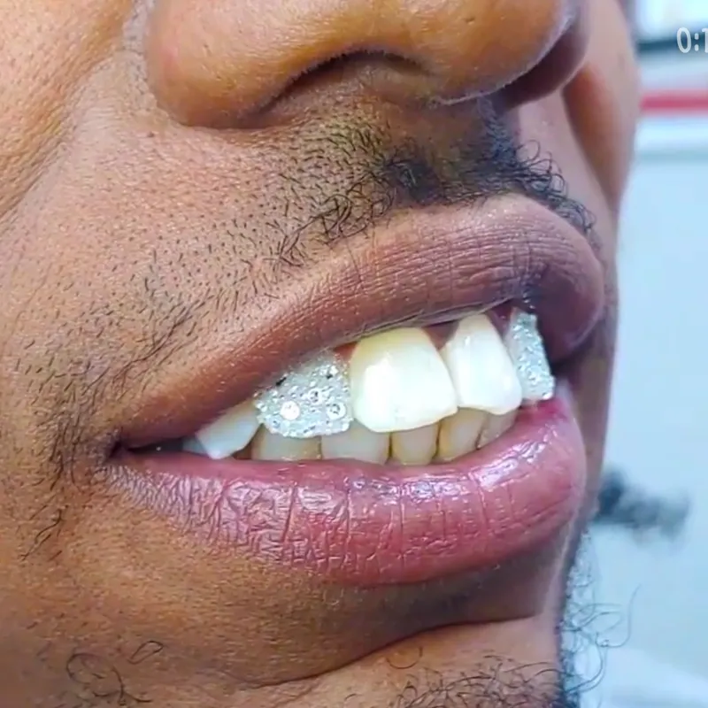 30234 teeth whitening new orleans 6