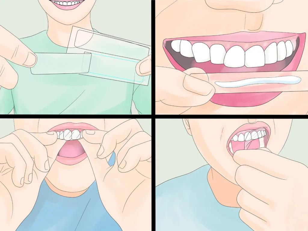 30236 whitening strips application