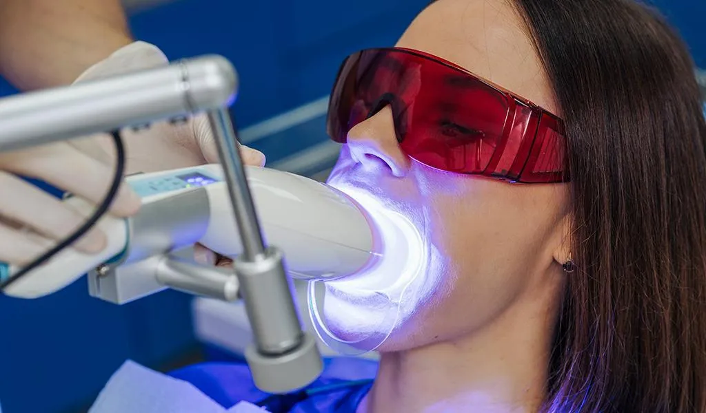 30239 teeth whitening york 5