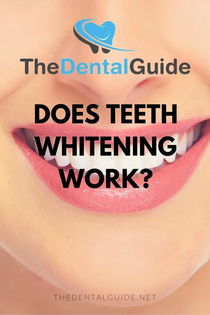 30240 types of teeth whitening