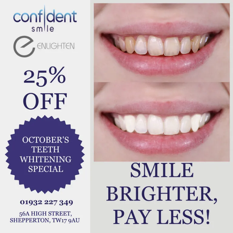 30247 teeth whitening south surrey aftercare