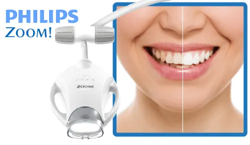 30247 teeth whitening south surrey professional