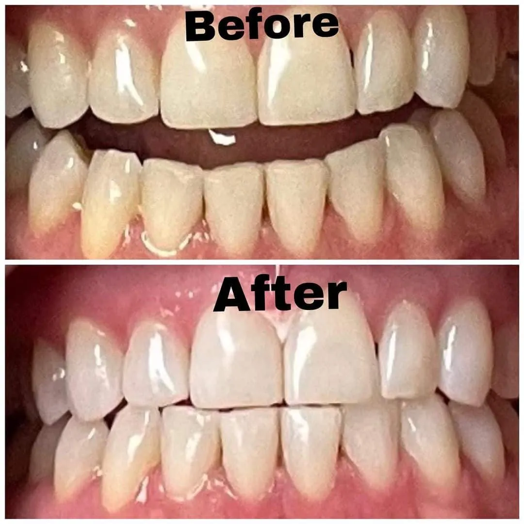 30273 teeth whitening san diego