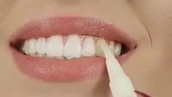 30276 teeth whitening comparison
