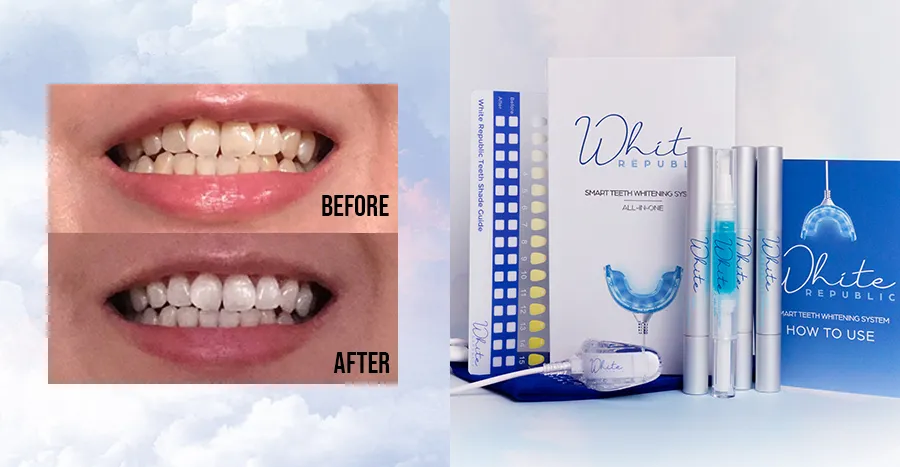 30280 best home whitening system