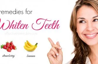 30286 whitening strips