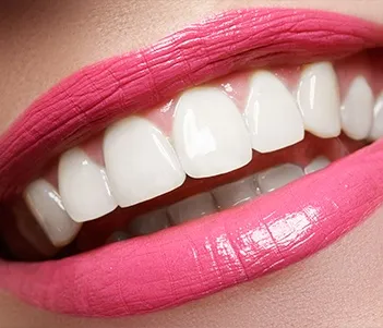 30288 teeth whitening vero beach options