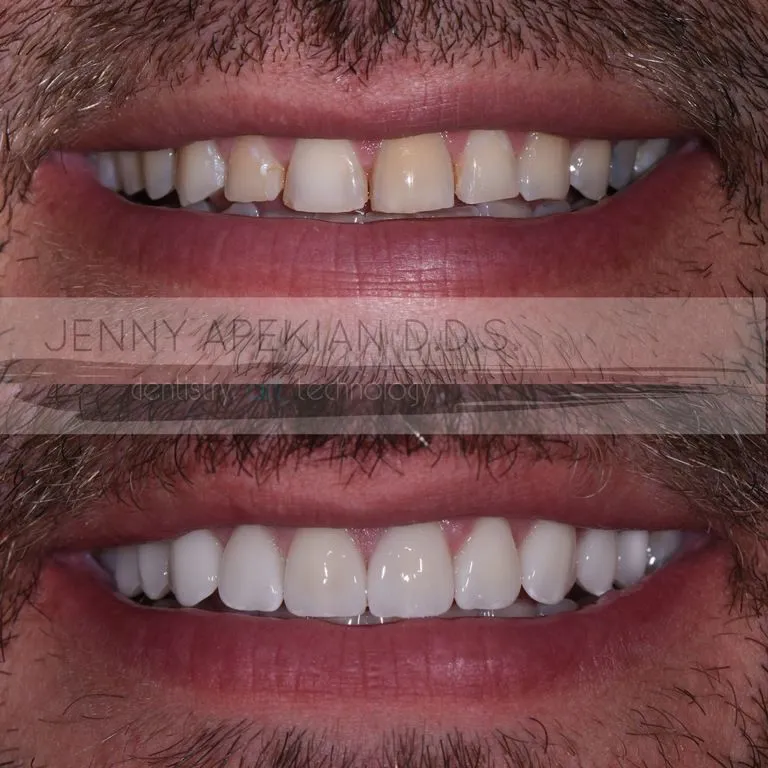 30289 brushing flossing techniques