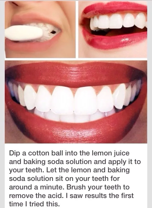 30291 baking soda lemon teeth whitening 7