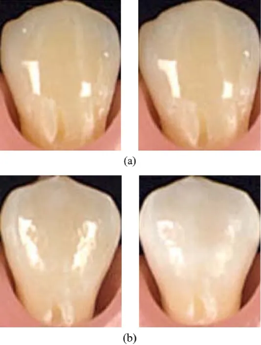 30294 confident smile