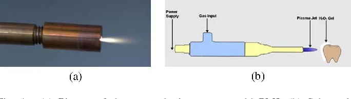 30294 teeth whitening alternatives