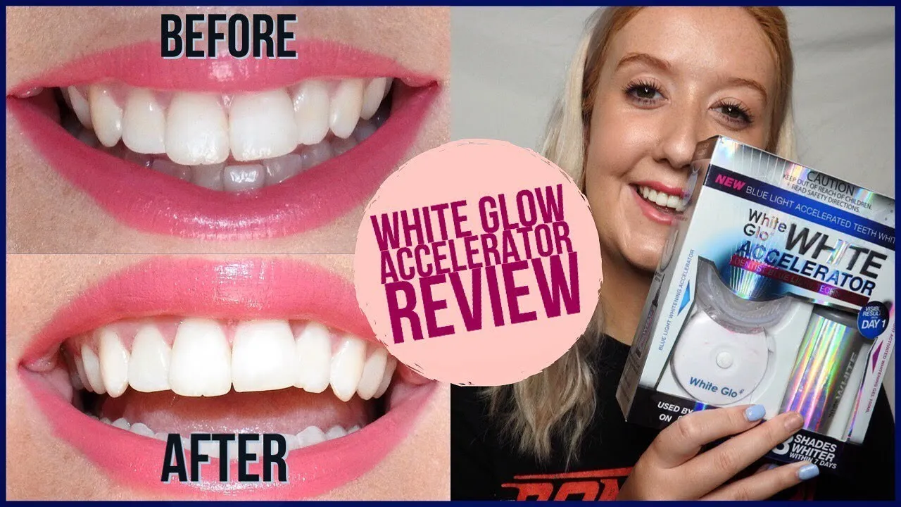 30296 teeth whitening pros cons