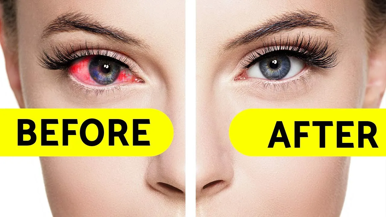 30297 dry skin around eyes