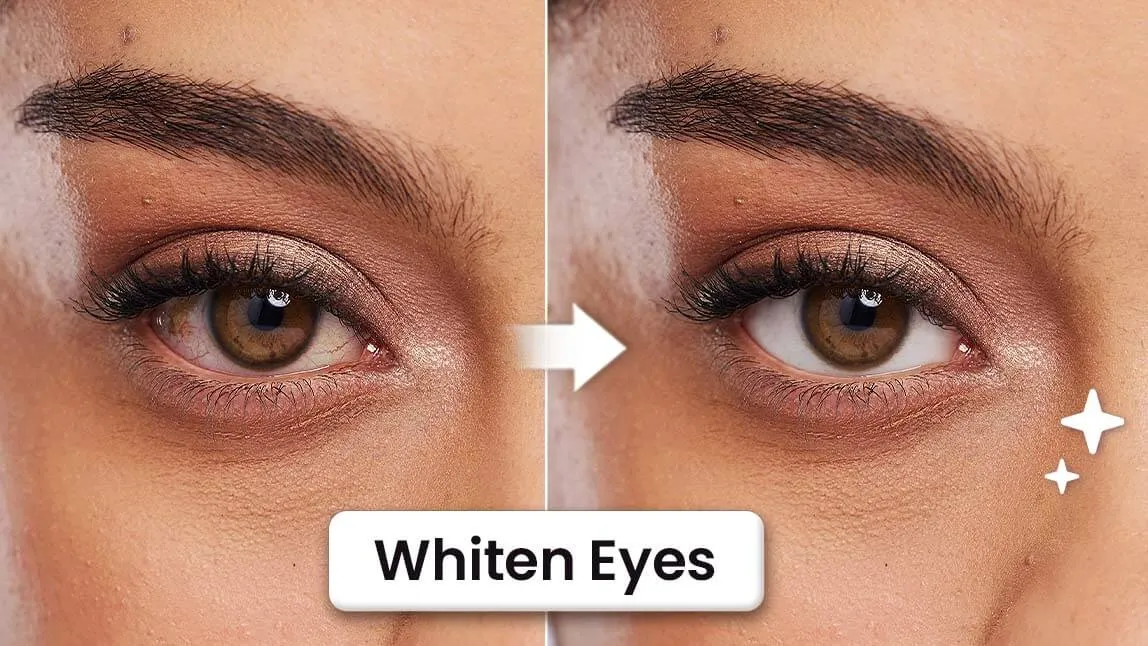 30297 eczema around eyes