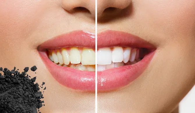 /img/30298-charcoal-powder-teeth-whitening-7.webp